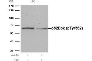 Western blot analysis of extracts from JK cells, treated with G-CSF or calf intestinal phosphatase (CIP), using p62Dok (phospho-Tyr362) Antibody. (DOK1 Antikörper  (pTyr362))