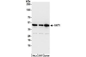 anti-Vesicle Amine Transport 1 (VAT1) (AA 1-50) antibody