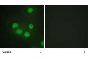 Immunofluorescence analysis of HepG2 cells, using SIX6 polyclonal antibody .