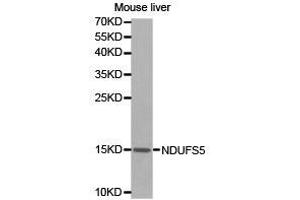 Western Blotting (WB) image for anti-NADH Dehydrogenase (Ubiquinone) Fe-S Protein 5, 15kDa (NADH-Coenzyme Q Reductase) (NDUFS5) antibody (ABIN1873864)