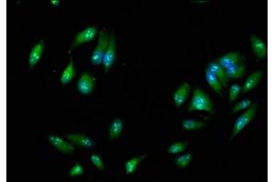 Immunofluorescence staining of Hela cells with ABIN7167480 at 1:266, counter-stained with DAPI. (RIPK3 Antikörper  (AA 1-518))