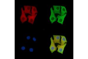 anti-Selenophosphate Synthetase 2 (SEPHS2) antibody