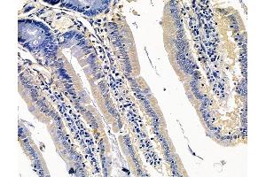 ABIN7095075 and ABIN7099131 at 1/100 staining rat colorectal tissue by IHC-P. (CRB3 Antikörper)