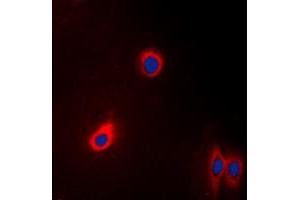 Immunofluorescent analysis of EEF2 staining in A431 cells. (EEF2 Antikörper  (N-Term))