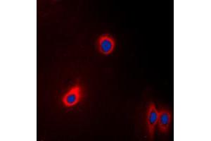 Immunofluorescent analysis of EEF2 staining in A431 cells. (EEF2 Antikörper  (N-Term))