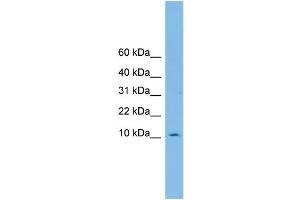 WB Suggested Anti-PHF5A Antibody Titration: 0. (PHF5A Antikörper  (Middle Region))