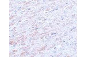 Immunohistochemistry of TCF3 in rat liver tissue with this product at 5 μg/ml. (TCF3 Antikörper  (N-Term))