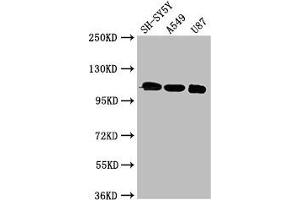 Western Blot Positive WB detected in: SH-SY5Y whole cell lysate, A549 whole cell lysate, U87 whole cell lysate All lanes: LRP8 antibody at 3 μg/mL Secondary Goat polyclonal to rabbit IgG at 1/50000 dilution Predicted band size: 106, 78, 100, 88 kDa Observed band size: 106 kDa (LRP8 Antikörper  (AA 131-332))