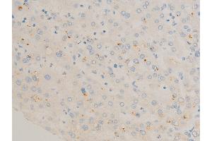 ABIN6267270 at 1/100 staining human liver tissue sections by IHC-P. (c-FOS Antikörper  (pSer362))