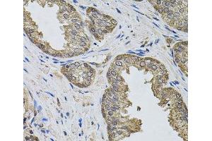 Immunohistochemistry of paraffin-embedded Human prostate using IGSF3 Polyclonal Antibody (IGSF3 Antikörper)