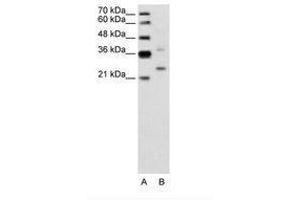 Image no. 2 for anti-Defective in Cullin Neddylation 1, Domain Containing 1 (DCUN1D1) (AA 31-80) antibody (ABIN6736642) (DCUN1D1 Antikörper  (AA 31-80))