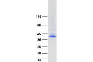 Western Blotting (WB) image for Microfibrillar-Associated Protein 4 (MFAP4) (Transcript Variant 1) protein (Myc-DYKDDDDK Tag) (ABIN2725910)