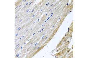 Immunohistochemistry of paraffin-embedded rat heart using PRPH antibody at dilution of 1:100 (x40 lens).