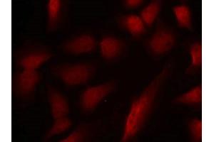 Immunofluorescence staining of methanol-fixed Hela cells using GATA1(Phospho-Ser310) Antibody. (GATA1 Antikörper  (pSer310))