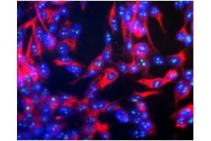 Immunofluorescence (IF) image for anti-Fibrillarin (FBL) antibody (ABIN371824) (Fibrillarin Antikörper)