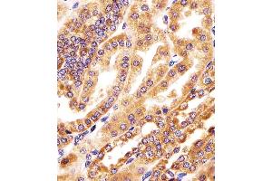 (ABIN6244258 and ABIN6578390) staining GMCL1 in human kidney tissue sections by Immunohistochemistry (IHC-P - paraformaldehyde-fixed, paraffin-embedded sections). (GMCL1 Antikörper  (AA 281-315))