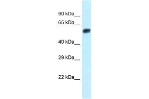 WB Suggested Anti-Eepd1 Antibody Titration: 1. (EEPD1 Antikörper  (N-Term))