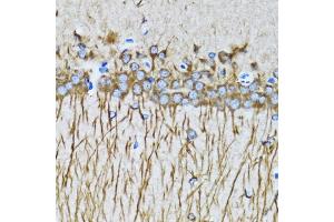 Immunohistochemistry of paraffin-embedded mouse brain using MAP1LC3A antibody. (MAP1LC3A Antikörper)