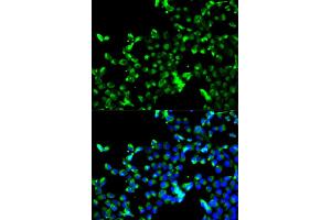 Immunofluorescence analysis of A549 cells using CALR antibody. (Calreticulin Antikörper)