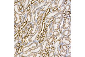 Immunohistochemistry of paraffin-embedded mouse kidney using S Rabbit mAb (ABIN7270501) at dilution of 1:250 (40x lens).