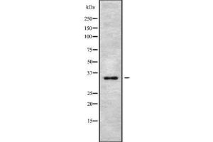 Western blot analysis of PIM2 using MCF7 whole cell lysates (PIM2 Antikörper  (N-Term))