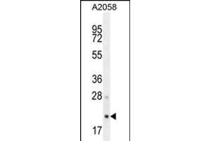 S1 Antibody (N-term) (ABIN654456 and ABIN2844190) western blot analysis in  cell line lysates (35 μg/lane).