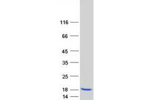 Western Blotting (WB) image for Myosin, Light Chain 1, Alkali, Skeletal, Fast (MYL1) protein (Myc-DYKDDDDK Tag) (ABIN2726660)
