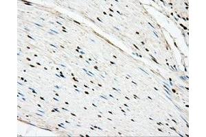 Immunohistochemical staining of paraffin-embedded liver tissue using anti-BSG mouse monoclonal antibody. (CD147 Antikörper)