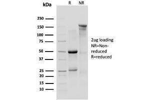 SDS-PAGE Analysis Purified IL-10R1 Rat Monoclonal Antibody (1B1. (IL-10RA Antikörper)