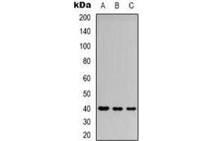 Western blot analysis of CD32b expression in Jurkat (A), SHSY5Y (B), HEK293T (C) whole cell lysates. (FCGR2B Antikörper  (C-Term))