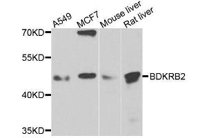 Western blot analysis of extracts of various cell lines, using BDKRB2 antibody. (BDKRB2 Antikörper  (AA 302-391))