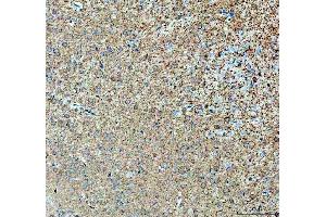 IHC analysis of ABI2 using anti-ABI2 antibody (ABIN7600125). (ABI2 Antikörper  (AA 151-400))