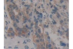 Immunohistochemistry (IHC) image for anti-Caspase Recruitment Domain Family, Member 9 (CARD9) (AA 26-283) antibody (ABIN7443479)