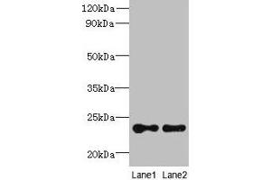 Western blot All lanes: TMED2 antibody at 6 μg/mL Lane 1: HCT116 whole cell lysate Lane 2: Mouse ovarian tissue Secondary Goat polyclonal to rabbit IgG at 1/10000 dilution Predicted band size: 23 kDa Observed band size: 23 kDa
