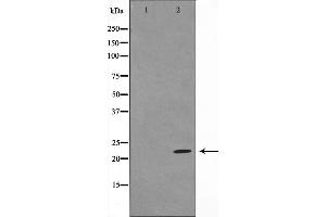 Western blot analysis of BAD expression in Forskolin treated 293 whole cell lysates,The lane on the left is treated with the antigen-specific peptide.