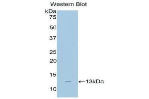 Western Blotting (WB) image for anti-beta-2-Microglobulin (B2M) (AA 22-119) antibody (FITC) (ABIN1172682)
