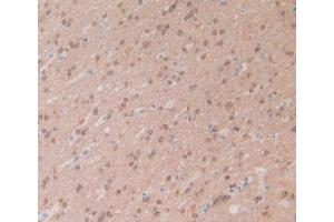 IHC-P analysis of Human Brain Tissue, with DAB staining. (CRYAB Antikörper  (AA 1-175))