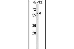 ZP4 Antibody (C-term) (ABIN656652 and ABIN2845893) western blot analysis in HepG2 cell line lysates (35 μg/lane).
