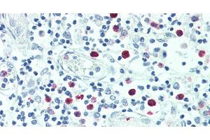 Immunohistochemistry of paraffin-embedded Thymus tissue using SRGN Polyclonal Antibody at dilution of 1:100. (SRGN Antikörper)