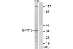 Western blot analysis of extracts from HT-29 cells, using GPR18 Antibody. (GPR18 Antikörper  (AA 131-180))