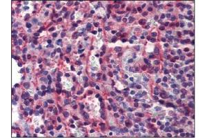 Immunohistochemistry (IHC) image for anti-Caspase 7, Apoptosis-Related Cysteine Peptidase (CASP7) antibody (ABIN614356) (Caspase 7 Antikörper)