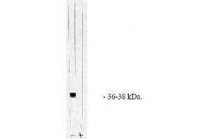 Image no. 1 for anti-Protein Phosphatase 1, Catalytic Subunit, alpha Isoform (PPP1CA) (AA 317-330), (C-Term), (Catalytic Subunit) antibody (ABIN264931) (PPP1CA Antikörper  (C-Term, Catalytic Subunit))