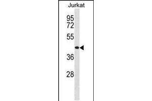 Western blot analysis in Jurkat cell line lysates (35ug/lane). (TRH Antikörper  (AA 209-238))