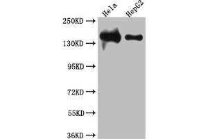 Western Blot Positive WB detected in: Hela whole cell lysate, HepG2 whole cell lysate All lanes: DNA Ligase I antibody at 1:1000 Secondary Goat polyclonal to rabbit IgG at 1/50000 dilution Predicted band size: 102, 89, 99 kDa Observed band size: 140 kDa (Rekombinanter LIG1 Antikörper)