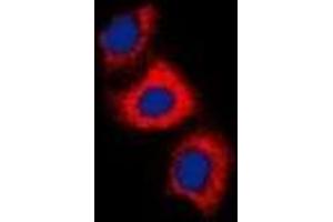 Immunofluorescent analysis of Recoverin staining in HeLa cells. (Recoverin Antikörper)