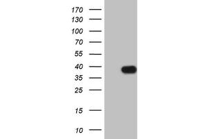 Western Blotting (WB) image for anti-Insulin-Like Growth Factor Binding Protein 1 (IGFBPI) (AA 26-259) antibody (ABIN2676854) (IGFBPI Antikörper  (AA 26-259))