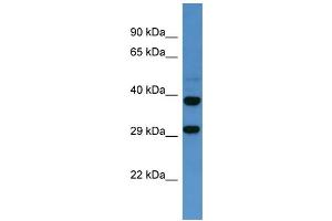 Western Blotting (WB) image for anti-Somatostatin Receptor 2 (SSTR2) (C-Term) antibody (ABIN2774261) (SSTR2 Antikörper  (C-Term))