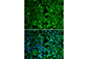 Immunofluorescence analysis of MCF-7 cells using RUNX3 antibody (ABIN6130682, ABIN6147314, ABIN6147315 and ABIN6223139). (RUNX3 Antikörper  (AA 210-429))