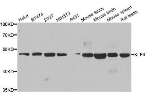 Western blot analysis of extracts of various cell lines, using KLF4 antibody. (KLF4 Antikörper  (AA 180-479))