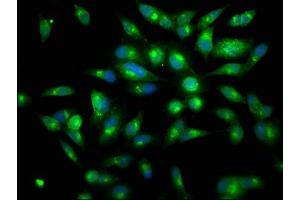 Immunofluorescence staining of Hela cells with ABIN7134517 at 1:150, counter-stained with DAPI. (Lactoferrin Antikörper)